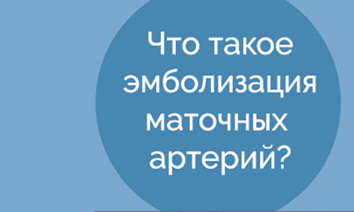 Инфографика по эмболизации маточных артерий