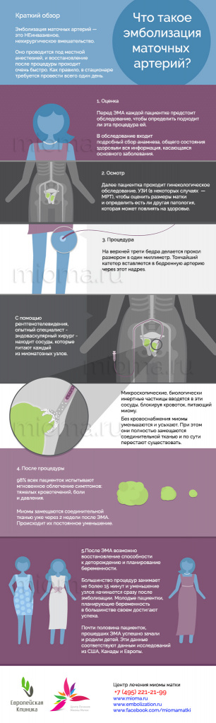 infografika-ema.jpg infografika-ema.jpg